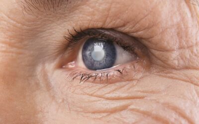 Quand faut-il envisager une intervention de la cataracte ?