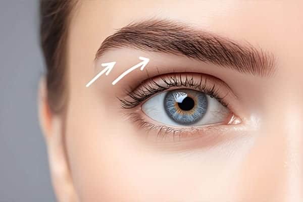 blepharoplastie definition ophtalmo paris 95 val d oise docteur pierre maxime leveque