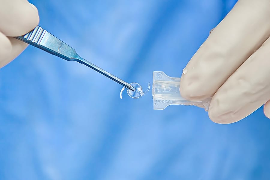 quels implants pour la cataracte operation cataracte docteur pierre maxime leveque chirurgien ophtalmologue paris val d oise