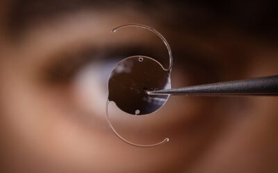 Corriger la presbytie avec une chirurgie de la cataracte