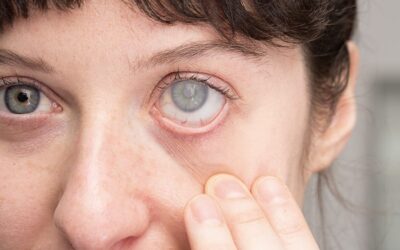 Quand faut-il opérer une cataracte ?